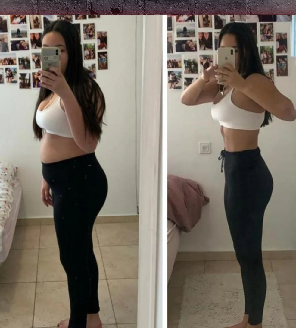 השוואת לפני ואחרי — תמונה 11