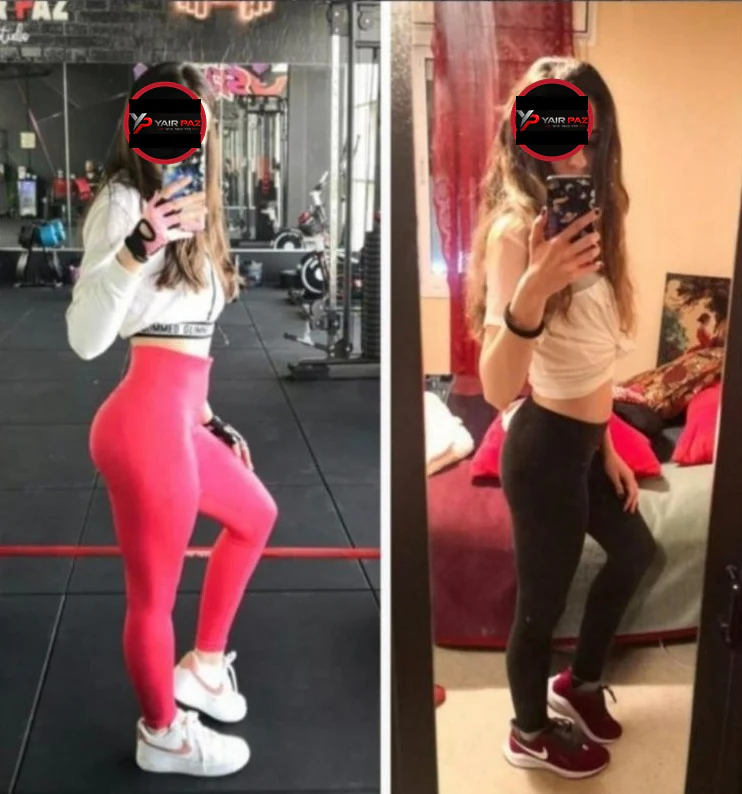 השוואת לפני ואחרי — תמונה 12