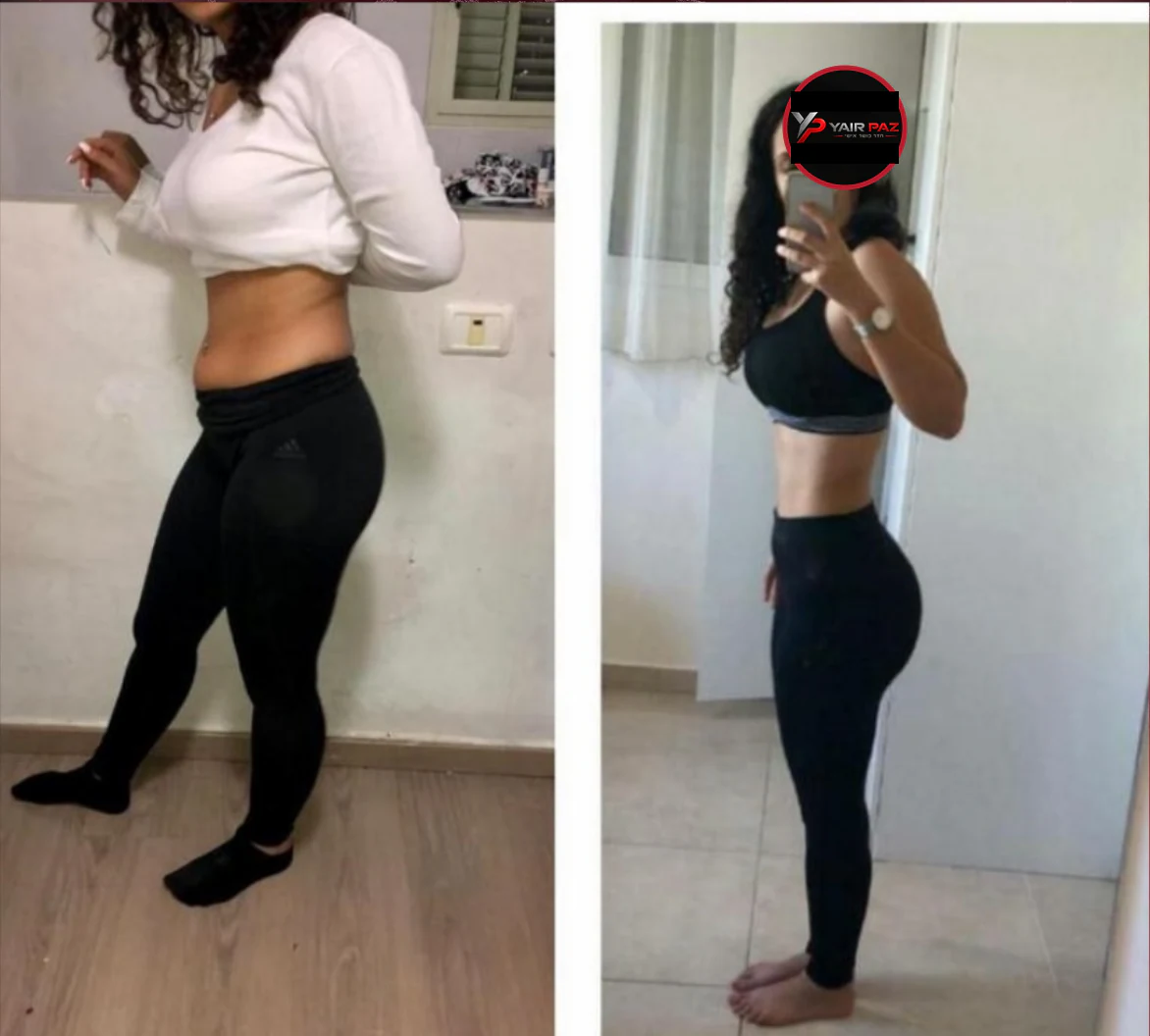 השוואת לפני ואחרי — תמונה 16