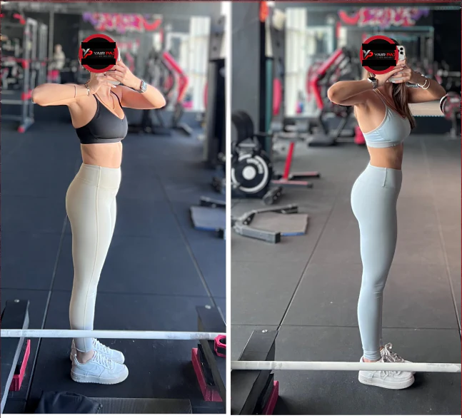 השוואת לפני ואחרי — תמונה 20