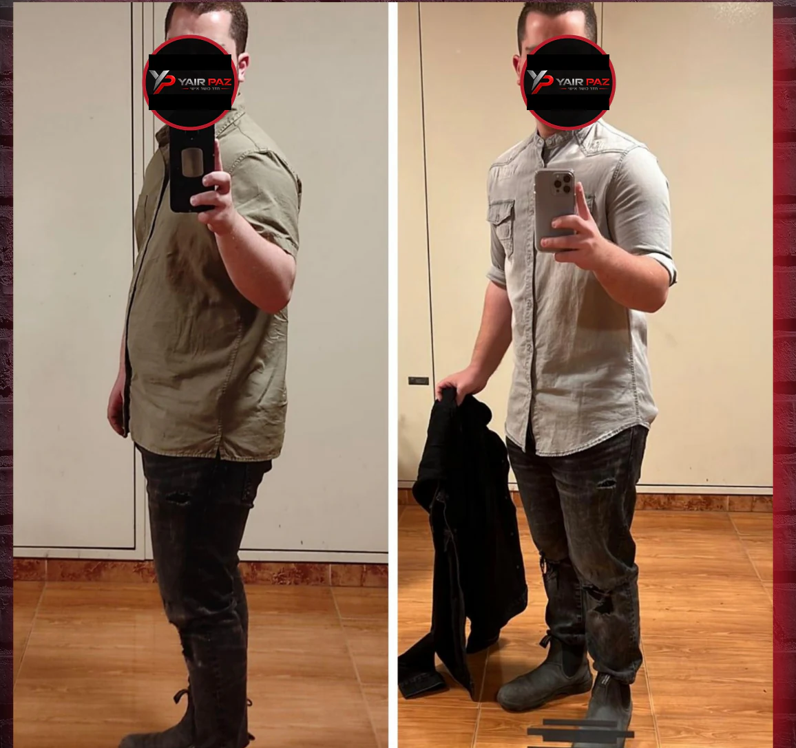 השוואת לפני ואחרי — תמונה 24